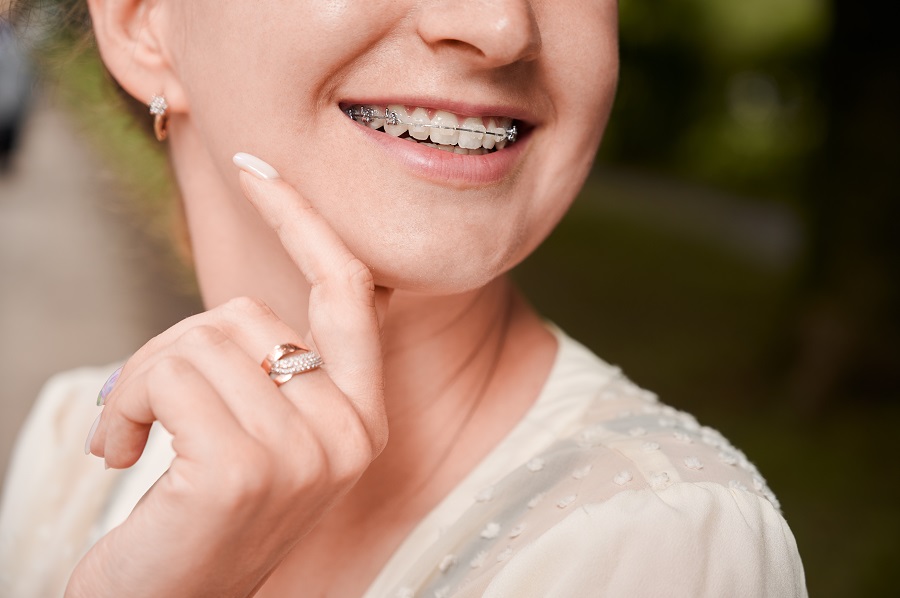 A General Dentist Discusses the Benefits of Tooth Straightening