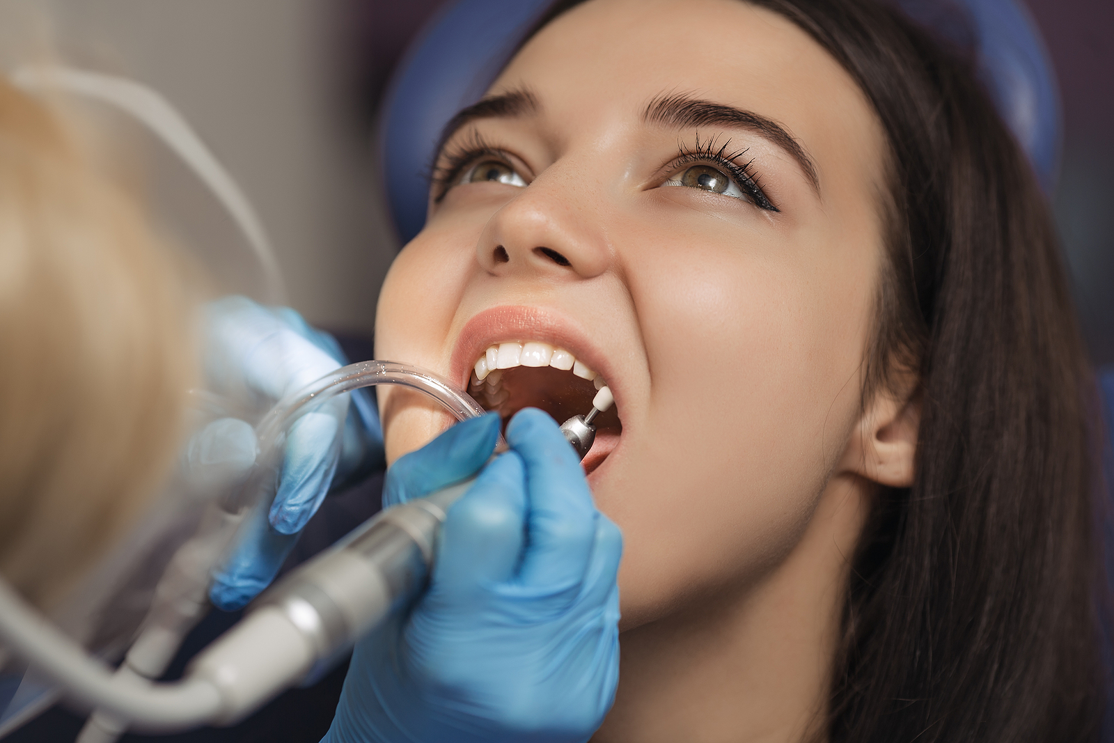 Essential Aftercare Tips for a Successful Dental Implant Recovery