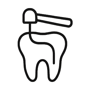 Root Canal